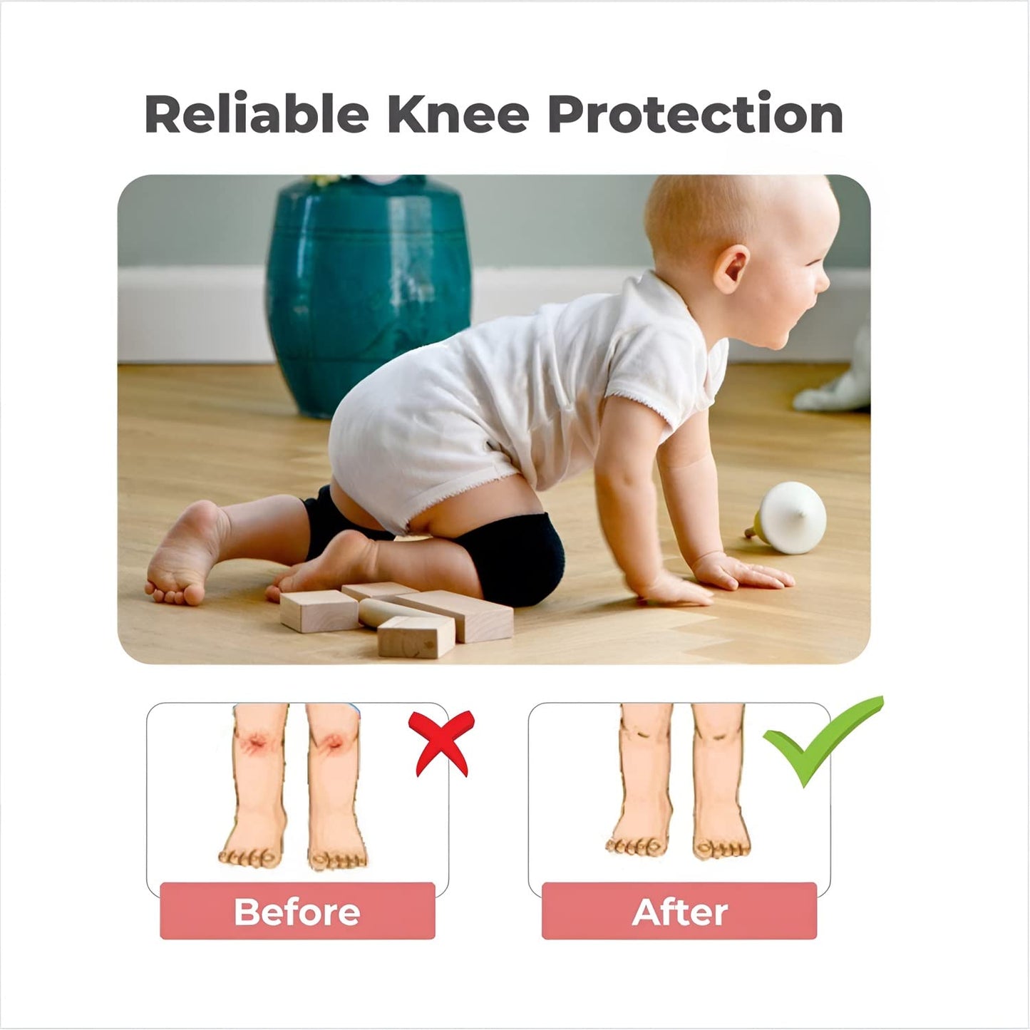 UK-0535 Baby Toddler Wool Knit Leg Warmer Knee Guard | Elbow & knee protector for infant (Multicolor)