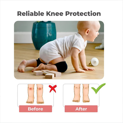 UK-0535 Baby Toddler Wool Knit Leg Warmer Knee Guard | Elbow & knee protector for infant (Multicolor)